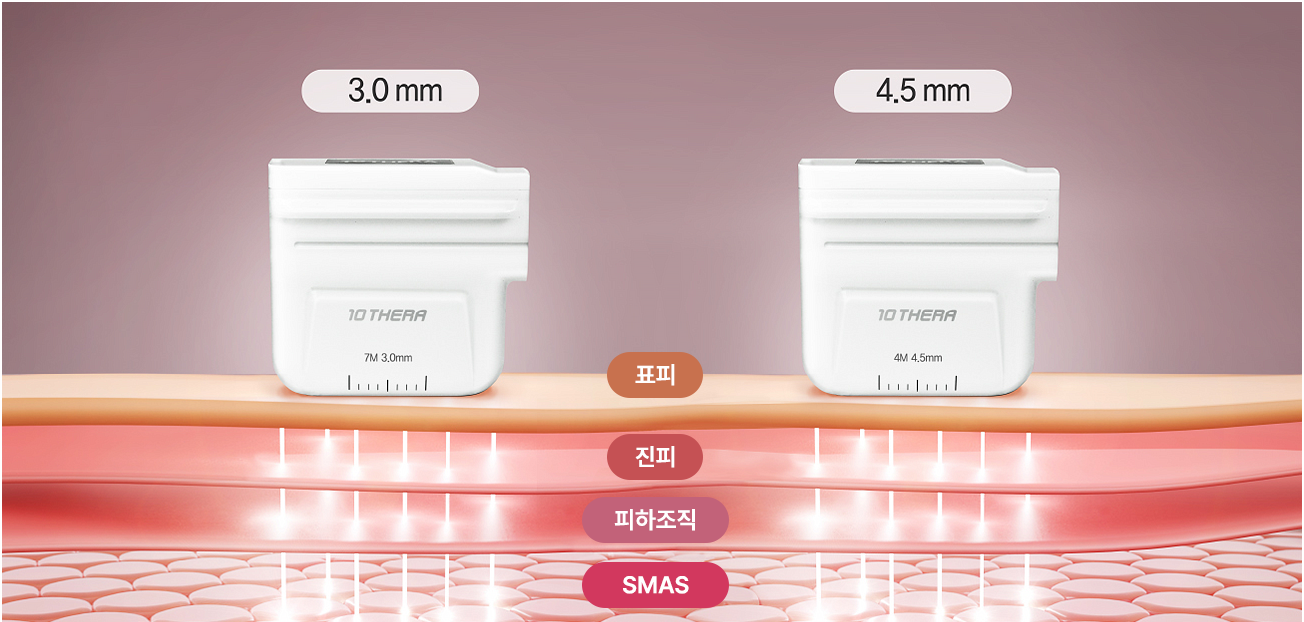 표피, 진피, 피하조직, SMAS